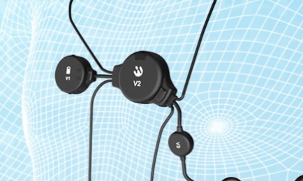 看下心脏远程监测‍的优势