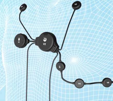 心电记录仪常见监测数据介绍