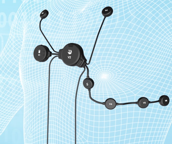 心电记录仪的重要价值：早期预测、诊断和治疗心血管疾病的利器！