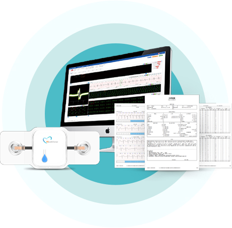 心脏远程监测的类型