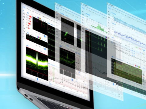 心脏康复监测的作用是什么？