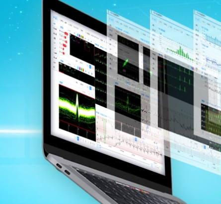 心脏远程监测的优点