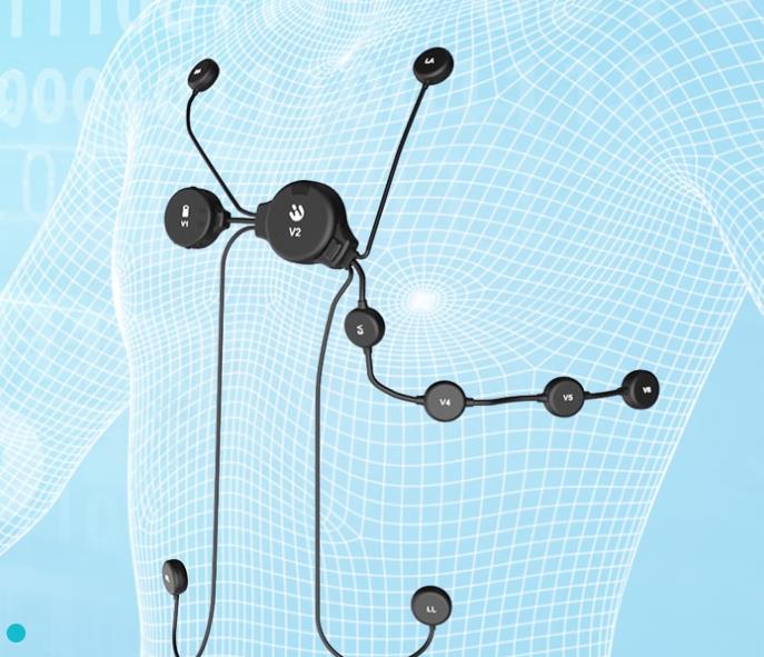 心电遥测设备如何促进健康生活方式？