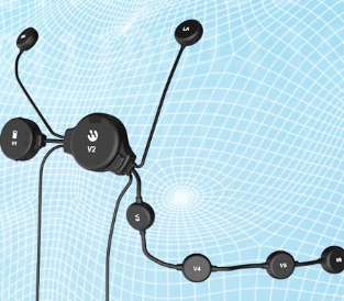 远程心电检测仪的功能有哪些