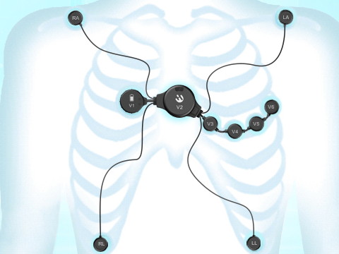 佩戴心脏康复监测设备有什么值得注意的?