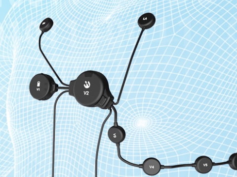 心脏远程监测仪具有哪些优点？实时数据传输.