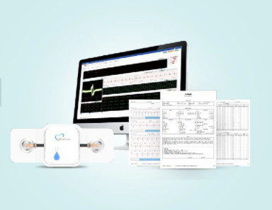 选择心脏远程监测仪器要考虑哪些要素？