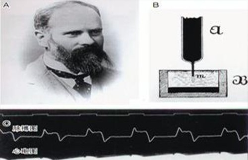回顾动态心电图的历史