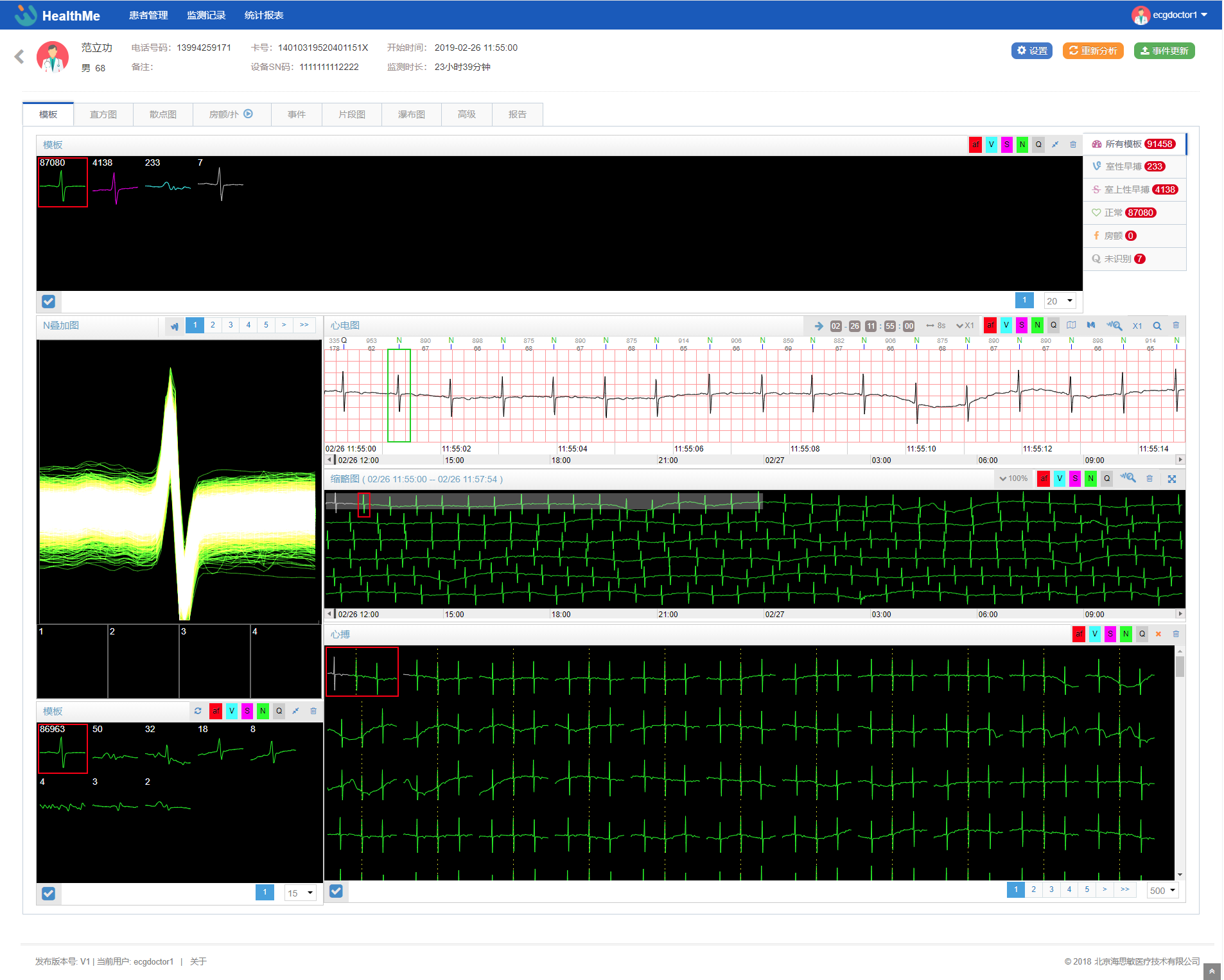 单导联长程连续心电图分析软件