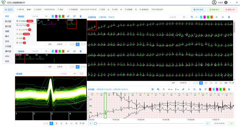 单导联长程连续心电图分析软件